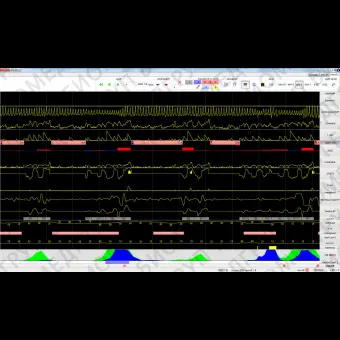 Программное обеспечение для полисомнографии