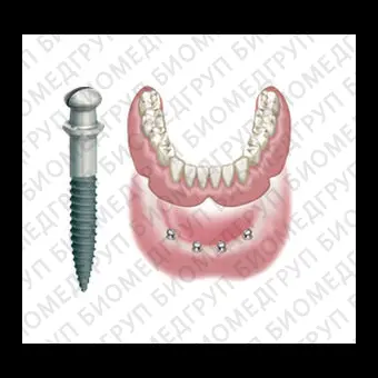 Конический зубной имплантат ATLAS