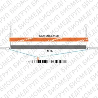 ДЛЯ КЛИЕНТОВ ЗА ПРЕДЕЛАМИ США. SureFISH 11q22.3 ATM 153kb P20 RD