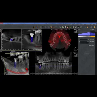 Программное обеспечение для обработки снимков зубов QuickVision 3D