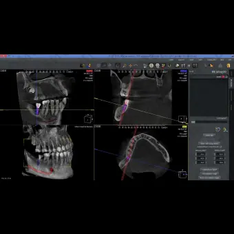 Программное обеспечение для обработки снимков зубов QuickVision 3D