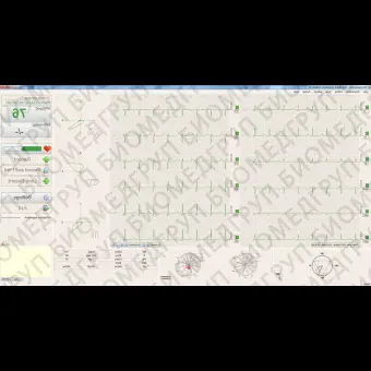 Электрокардиограф для спокойного состояния BTL CardioPointECG C600