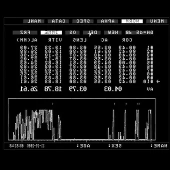 Офтальмологический эхограф ODM2200