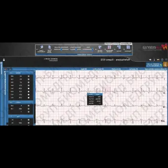 Программное обеспечение для кардиологии SUITESTENSA CVIS PACS