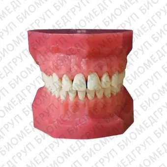 ЧВН28У  дентомодель верхней и нижней челюстей для практики удаления зубов