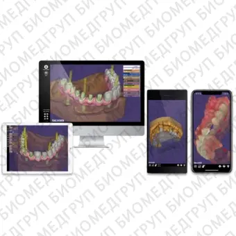 Exocad 2018 Valletta  программное обеспечение для компьютерного моделирования стоматологических реставраций