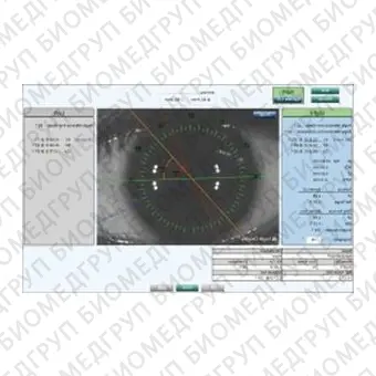 Оптический биометр ALScan