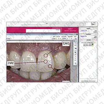 Программное обеспечение для стоматологических лабoраторий VITA ShadeAssist, VITA ToothConfigurator