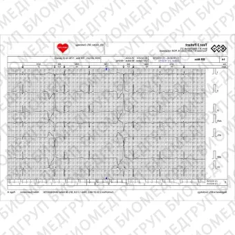 Кардиомонитор Холтера 12 каналов BTL CardioPointHolter H600